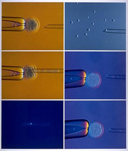Stages of Nuclear Transfer using Microscopic Needle